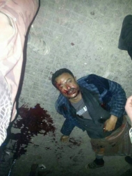 صورة المجني عليه