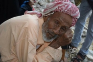 من نازحي الحرب الذين هجرتهم المليشيا قسرا من القرى - تعز 