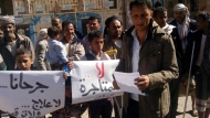وقفة احتجاجية لجرحى الجيش والمقاومة في التربة بتعز تطالب بسرعة علاجهم