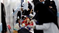 الصحة العالمية: 51 حالة وفاة بسبب الكوليرا في اليمن