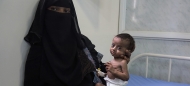 تقارير اممية: 4.5 مليون يمني في مناطق الشرعية يعانون من مستويات عالية من انعدام الأمن الغذائي الحاد