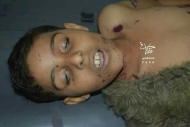 احد الاطفال الضحايا بمجزرة المليشيا في مدينة تعز اليوم الخميس