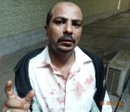 الشرطه العسكرية بالحديدة تعتدي علي مدير عام التعليم الفني والمهني