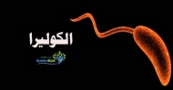 اكتشاف 5 حالات كوليرا في محافظة الضالع