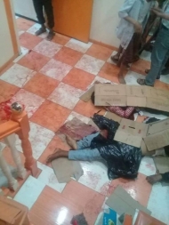 تعز..صورة من مجزرة المليشيات لحي النور السكني