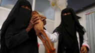 &copy; أم تحمل ابنها المصاب بسوء التغذية بسبب نقص المواد الأساسية في مدينة الحديدة اليمنية (رويترز 17-11-2016)