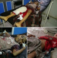 صورة من الارشيف لضحايا مدنيين بقصف المليشيات في تعز
