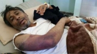 صحفيون يناشدون الرئيس هادي انقاذ حياة الزميل غزوان